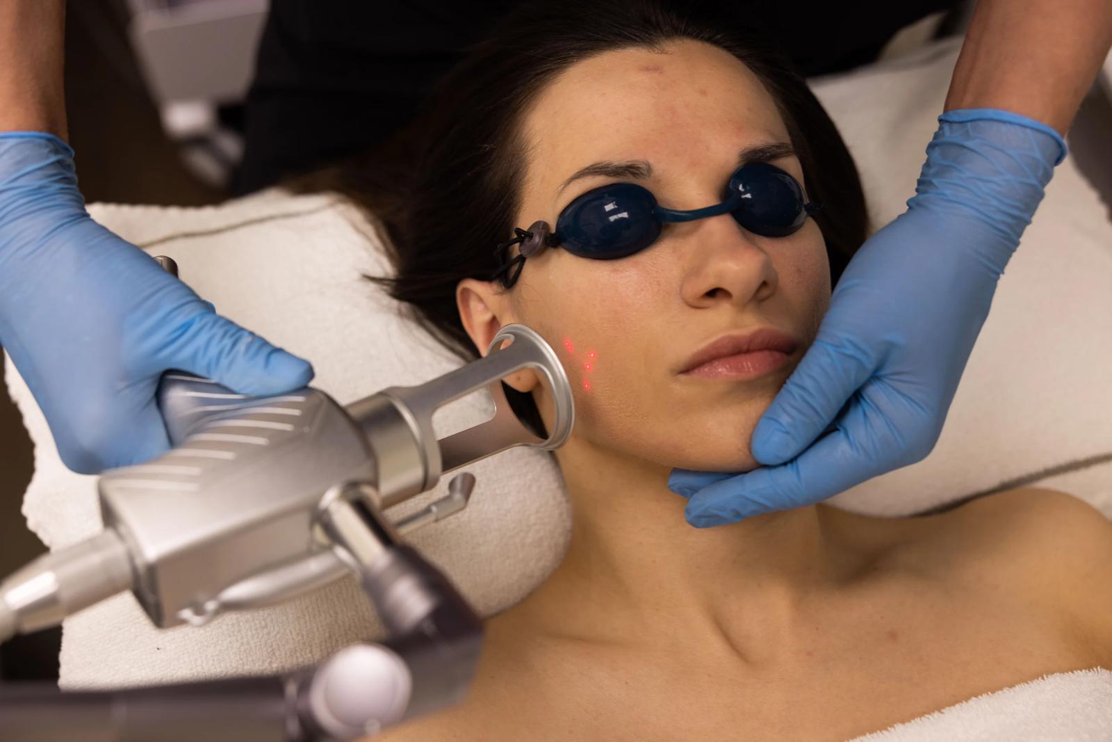 CO2 fractional Laser