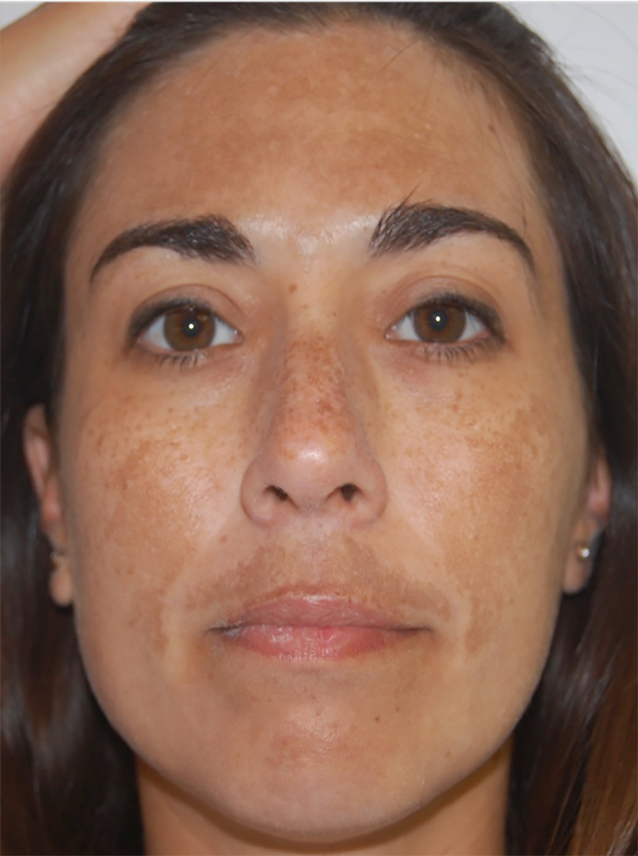 Saizar_toning_before