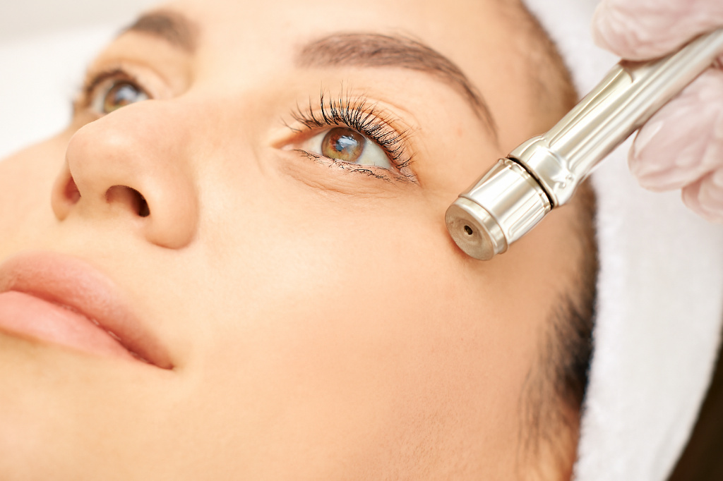 H Gracefully Diamond Dermabrasion Toronto Facial Resurfacing Procedure