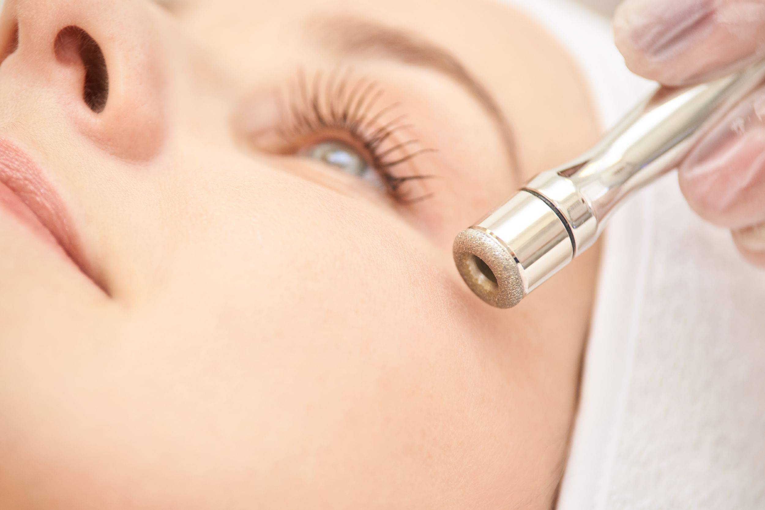 H Gracefully Diamond Dermabrasion Toronto Microdermabrasion Facial Treatment