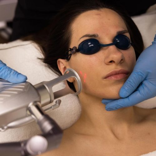 CO2 fractional Laser