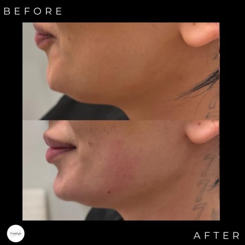 WhatsApp Image 2026-01-20 at 1.48.54 AM (2)