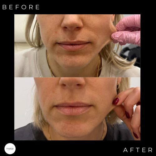 WhatsApp Image 2026-01-20 at 1.48.54 AM (3)