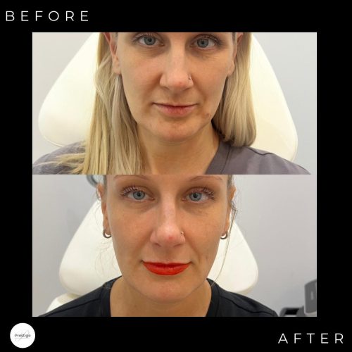 WhatsApp Image 2026-01-20 at 1.48.54 AM (4)