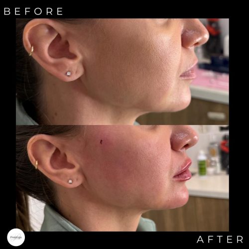 WhatsApp Image 2026-01-20 at 1.48.54 AM (5)